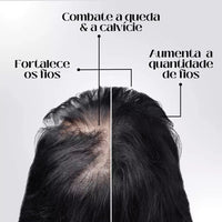 Kit 4 Repair Hair Regrowth - Compre 1 Leve 4 - Óleo de Crescimento Capilar
