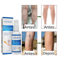 Compre 1 Leve 2 - Spray Varibooster Clear - Frete Grátis + 2 Brindes