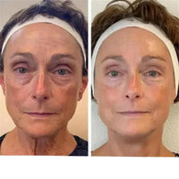 Compre 1 Leve 4 - Creme Celyn Para Olheiras, Pálpebras e Rugas