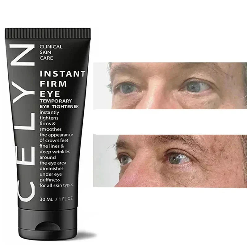 Compre 1 Leve 4 - Creme Celyn Para Olheiras, Pálpebras e Rugas